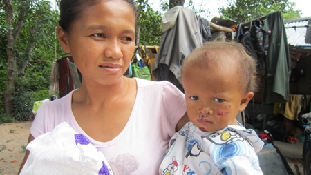 Mr. Rung’s family, one of our special cases. The rainy season brings them more woe than usual. 