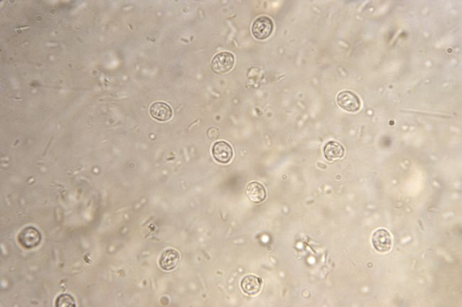 This microscope image provided by the Centers for Disease Control and Prevention shows Cryptosporidium parvum parasitic organisms in a stool smear specimen, the cause of a patient’s cryptosporidiosis. The CDC said hotel pools and hot tubs are a major source of the diarrheal illnesses people get from swimming. The parasite can survive normal chlorine levels. (CDC via AP)
