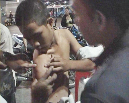 One of the victims shows his gunshot wound to paramedics.