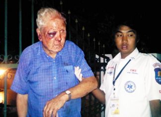 Gerard Joseph Browne suffered cuts and swelling to the face from an April 20 mugging.