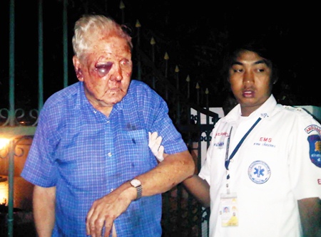 Gerard Joseph Browne suffered cuts and swelling to the face from an April 20 mugging.