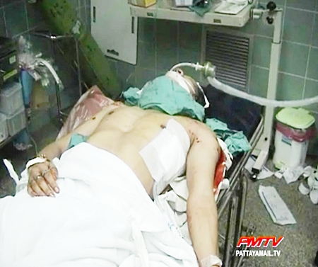 The wounded man is treated at hospital