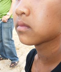Cambodian woman, 3 kids rescued from abusive husband The 14-year-old girl shows rescuers some of the scars from the abuse her stepfather inflicted upon her.