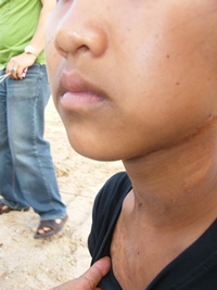 The 14-year-old girl shows rescuers some of the scars from the abuse her stepfather inflicted upon her. 