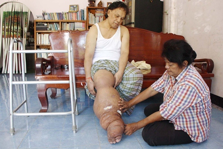 The Rojnapanitkul family is looking for help for Nattawat’s condition.