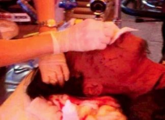 5 injured in explosion at anti-govt rally site