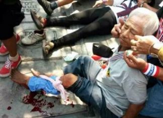 Dozens wounded in bomb attack against anti-govt protesters