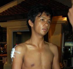 Burmese Jai Khamsaen, knifed in a gang attack in front of a Pattaya mall, is facing rape charges and deportation.