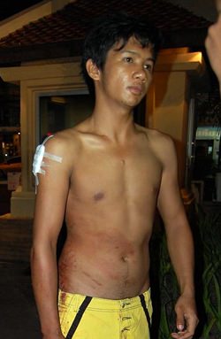 Burmese Jai Khamsaen, knifed in a gang attack in front of a Pattaya mall, is facing rape charges and deportation.