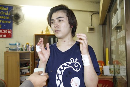 Sutthipong Toonrath suffered minor injuries after allegedly being stabbed by his overly possessive former boyfriend.