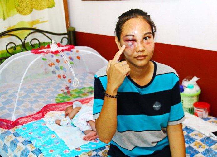 Police are seeking a Sattahip man who allegedly beat his 19-year-old niece to the point she nearly lost an eye.