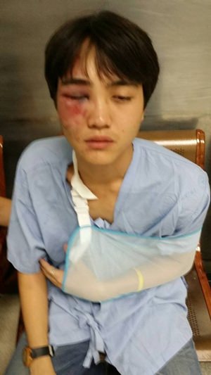 Paveekorn Samphanwiwat reported to police after he was assaulted by a man in front of the CMU Engineering Gate, he suffered a broken arm and said he didn’t know the man who attacked him.