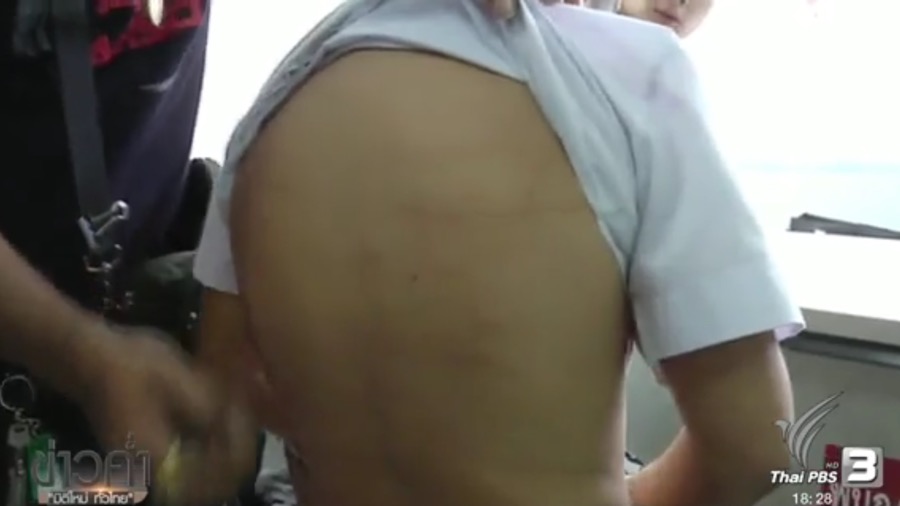thailand-news-30-12-16-pbs-4-50000-baht-cash-remedy-offered-in-child-beating-case-1jpg