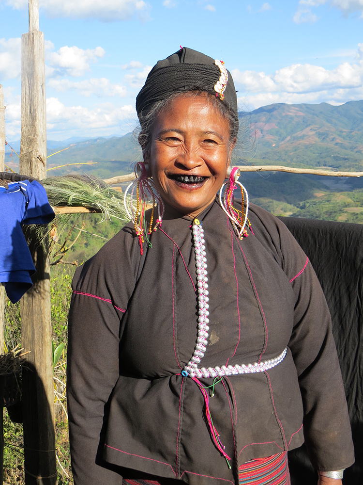 This Eng grandmother sports the traditional blackened teeth of her tribe.
