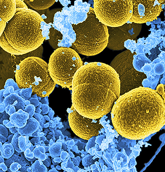 This microscope image provided by the National Institute of Allergy and Infectious Diseases (NIAID) shows Staphylococcus aureus bacteria in yellow (the larger round shapes). New research found protective bacteria in healthy skin produce natural antibiotics that can guard against disease-causing Staph aureus. (National Institute of Allergy and Infectious Diseases via AP)