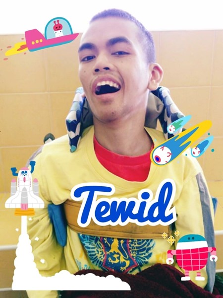 Tewid is of the 3rd child we provide 24/7 for at the Camillian Home along with his mom at the center.