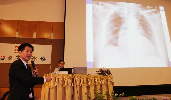 Cardiovascular surgeon Dr. Siriwasan Oknitthapichart, intensive care unit chief Dr. Thiphon Napaprasit and Nurse Awaphon Kanta were the panelists for a discussion on critical care nursing for heart patients.