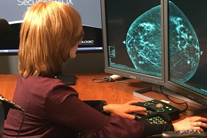 In this Nov. 21, 2017, Dr. Tova Koenigsberg at The Montefiore Einstein Center for Cancer Care in New York shows an example of a traditional mammogram scan. U.S. health officials are beginning a huge study to compare traditional mammograms with 3-D versions, to see if the newer choice might really improve screening for breast cancer. (Montefiore Health System via AP)