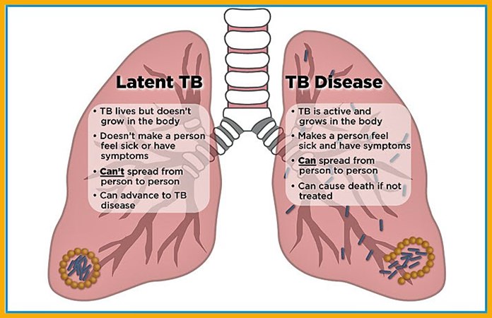 This graphic shows a comparison of Latent TB and Disease TB. Source: https://www.tbfacts.org/