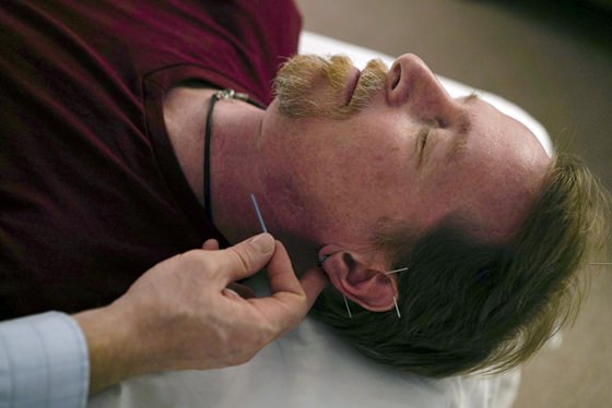 David Ramsey, a Medicaid patient who suffers from chronic pain after falling off a cliff in 2011, receives acupuncture treatment in Warrensville Heights, Ohio. Long derided as pseudoscience, acupuncture is increasingly being used by doctors and officials seeking a new weapon in the nation’s struggle with opioids. (AP Photo/Dake Kang)