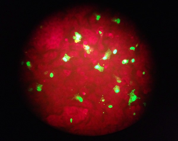 In this Feb. 26, 2015 photo taken through the eyepiece of a microscope, human cells infected with the flu virus glow green under light from a fluorescence microscope at a laboratory in Seattle. The U.S. government estimates that 80,000 Americans died of flu and flu complications in the winter of 2017-2018 - the highest flu-related death toll in at least four decades. (AP Photo/Ted S. Warren)