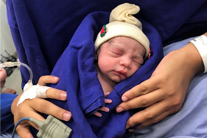 This Dec. 15, 2017 photo provided by transplant surgeon Dr. Wellington Andraus shows the baby girl born to a woman with a uterus transplanted from a deceased donor at the Hospital das Clinicas of the University of Sao Paulo School of Medicine, Sao Paulo, Brazil, on the day of her birth. Nearly a year later, mother and baby are both healthy. (Courtesy Dr. Wellington Andraus via AP)