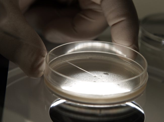 A researcher examines human embryonic stem cells with a microscope in Michigan. On Thursday, Dec. 20, 2018, the Centers for Disease Control and Prevention reported that at least 12 patients in three states became infected after getting embryonic stem cell injections for problems like joint and back pain. (AP Photo/Paul Sancya, File)
