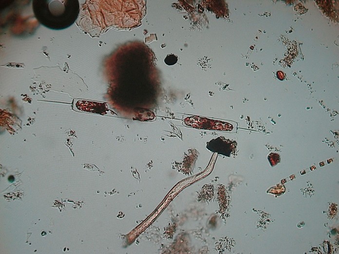 This May 30, 2019 photo shows an enlarged image of microscopic sea creatures being studied in a laboratory at Monmouth University in West Long Branch, N.J. University researchers are studying the relationship between heavy rainfall and elevated levels of bacteria from animal waste that gets flushed into storm sewers and out in the ocean at popular surfing beaches at the Jersey shore. (AP Photo/Wayne Parry)
