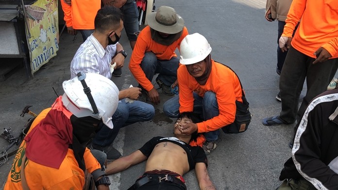 Nop, who was electrocuted when he touched a still-active high-voltage wire while tidying up power lines in South Pattaya, suffered burns to the arm and foot and was transported to Banglamung Hospital.