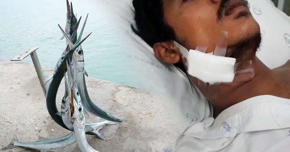 t 08 Needlefish hit swimmers neck in Trat East Thailand 1