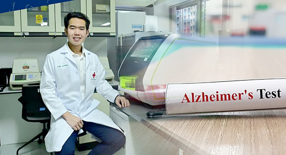 t 12 Chulalongkorn University develops early Alzheimers detection test