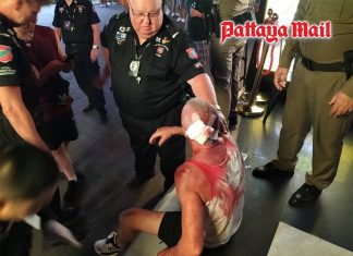 Australian tourist suffers mysterious head injuries in Pattaya Walking Street pub