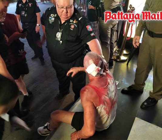 Australian tourist suffers mysterious head injuries in Pattaya Walking Street pub