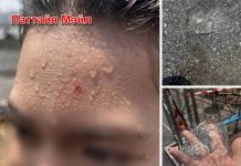 Предупреждение на Сонгкран: женщина пострадала из-за льда во время водных игр в Удонтхани