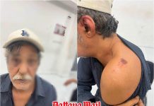 Pattaya bar night turns into robbery leaving Kuwaiti tourist injured
