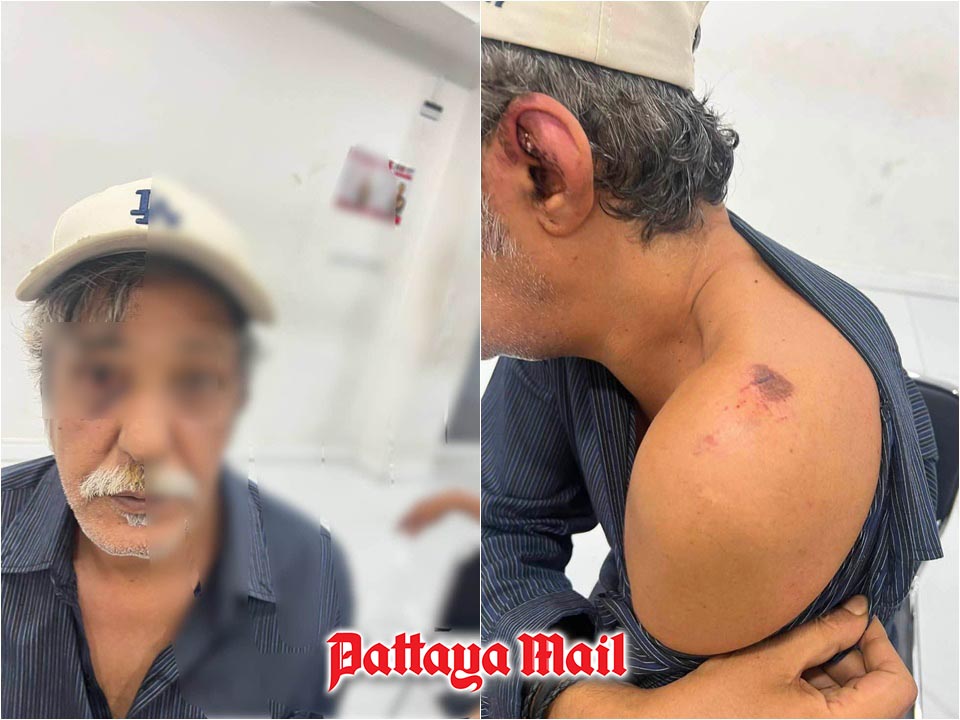 Pattaya bar night turns into robbery leaving Kuwaiti tourist injured