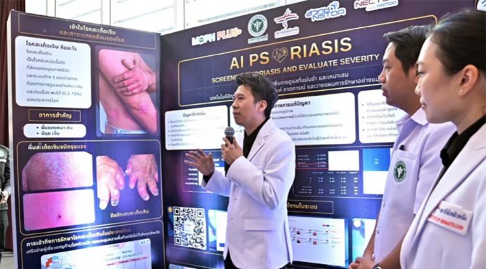 Thailand’s new AI tool offers 95% accuracy in Psoriasis screening