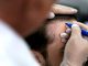 Hair Transplant in Thailand: What to Know Before Treatment