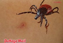 Thailand watches deadly tick-borne virus after six SFTS cases