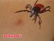 Thailand watches deadly tick-borne virus after six SFTS cases
