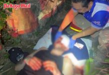 German tourist seriously injured after falling from second-floor Pattaya hotel balcony