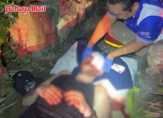 German tourist seriously injured after falling from second-floor Pattaya hotel balcony